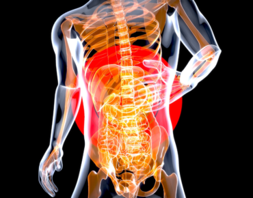 Sciatica Pain
