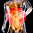 Sciatica Pain