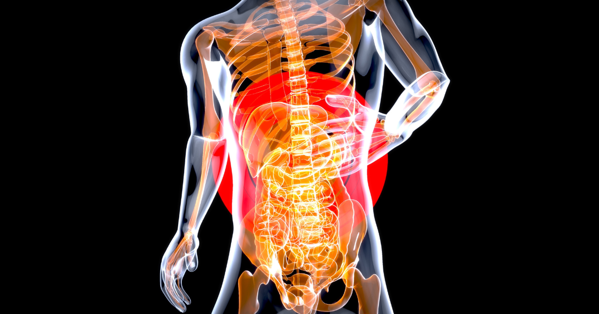 Can Chiropractic Adjustments Relieve Severe Sciatica Pain?